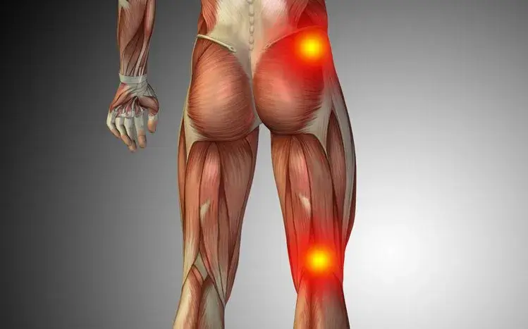 Physical Therapy Found to Provide Greater Sciatica Relief in Recent Study